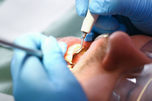 Best Emergency Gum Treatment in Middletown, CT